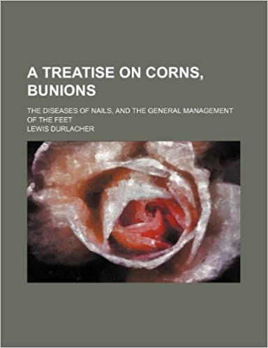 A Treatise on Corns, Bunions; The Diseases of Nails, and the General Management of the Feet