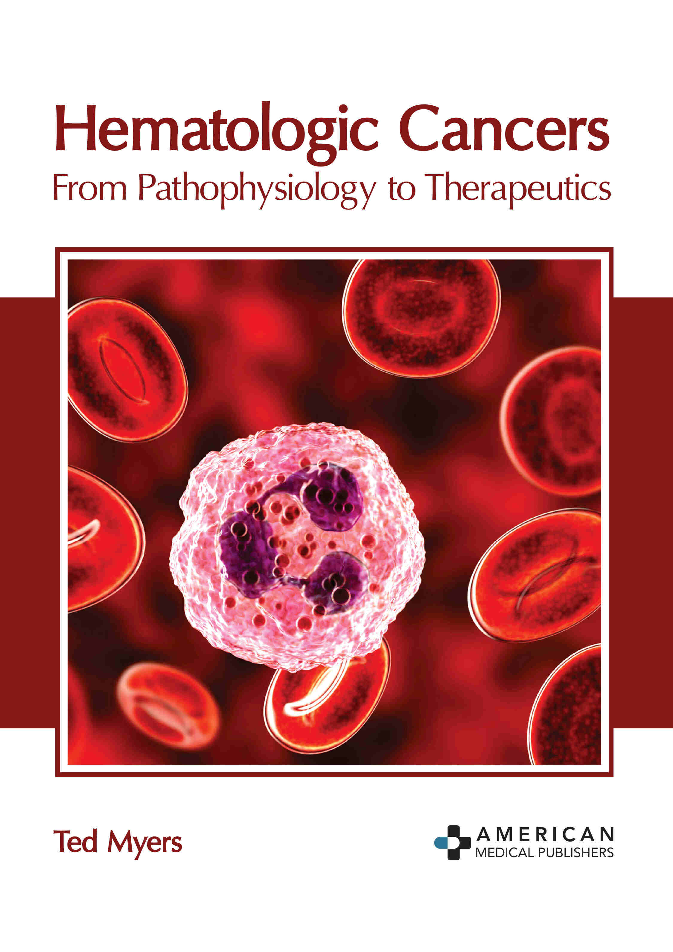 Hematologic Cancers: From Pathophysiology to Therapeutics
