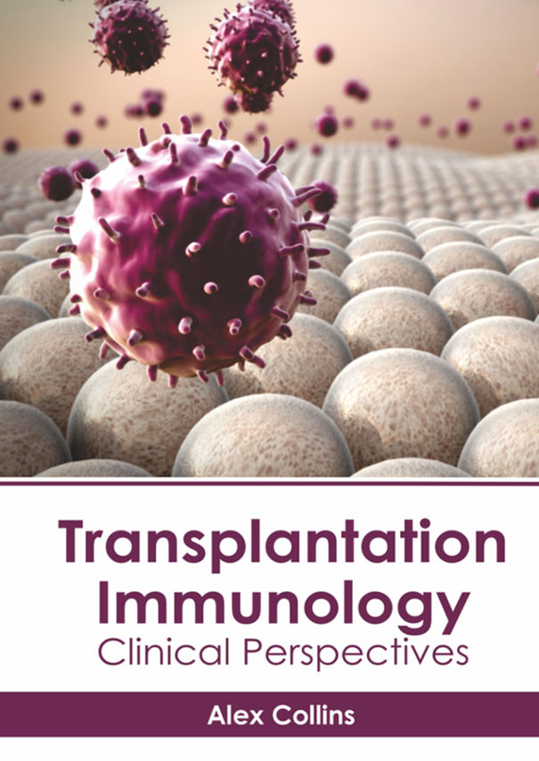 Transplantation Immunology: Clinical Perspectives