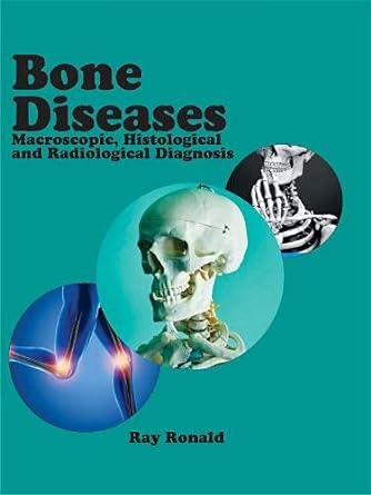 Bone Diseases: Macroscopic, Histological and Radiological Diagnosis