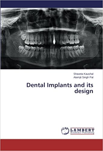 Dental Implants and Its Design