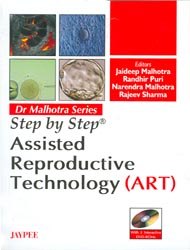 STEP BY STEP ASSISTED REPRODUCTIVE TECHNOLOGY(ART) WITH 2 INT.DVD-ROMS DR.MALHOTRA SERIES