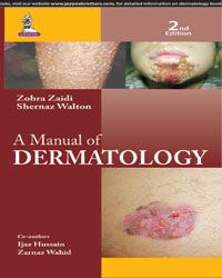 A MANUAL OF DERMATOLOGY