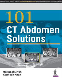 101 CT ABDOMEN SOLUTIONS