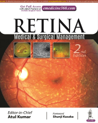 RETINA: MEDICAL & SURGICAL MANAGEMENT