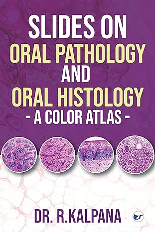 Slides on Oral Pathology and Oral Histology - A Color Atlas