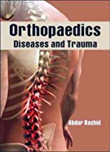 Orthopaedics Diseases And Trauma: For UG And PG Including Traumatology And Diseases