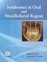 Syndromes in Oral and Maxillofacial Region 