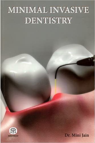 Minimal Invasive Dentistry 