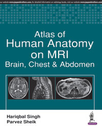 ATLAS OF HUMAN ANATOMY ON MRI:BRAIN, CHEST & ABDOMEN