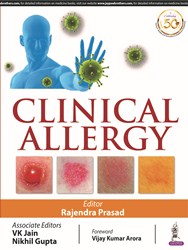 CLINICAL ALLERGY