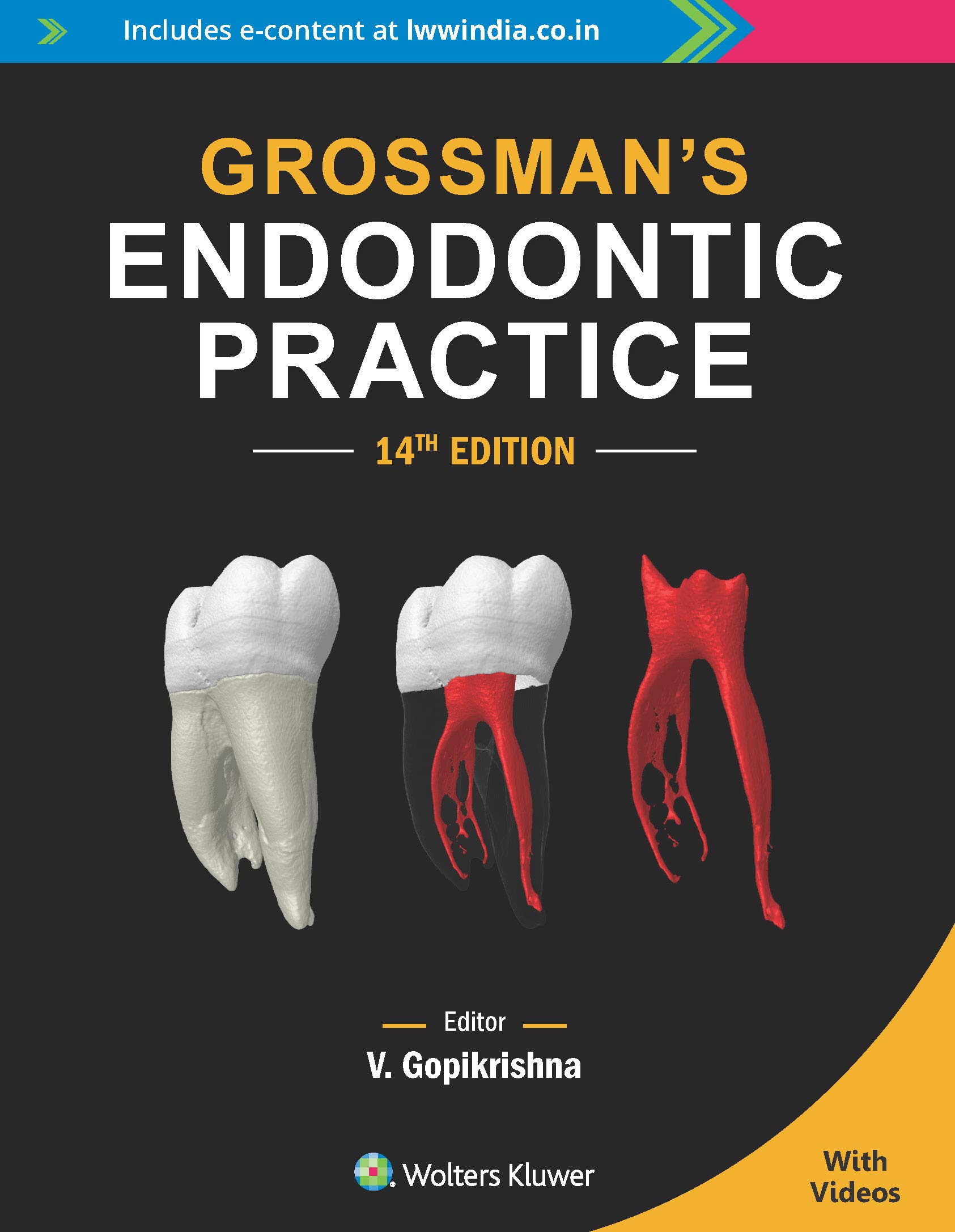 Grossmanâ's Endodontic Practice, 14th edition